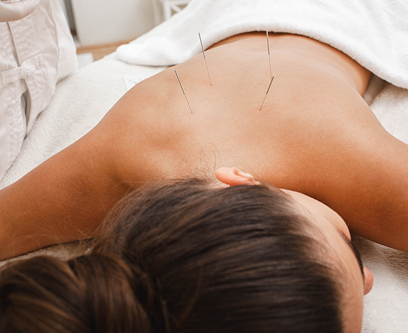 Acupuncture for Back Pain Relief | Brookfield WI