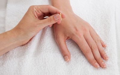 What is the Difference Between Dry Needling & Acupuncture?