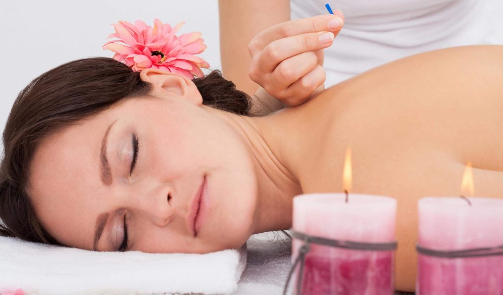 Acupuncture FAQ's where do they place the acupuncture needles