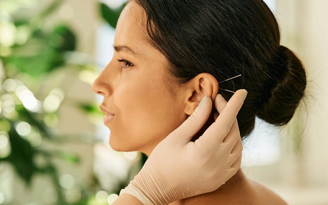 Acupuncture FAQ’s