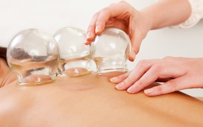 Cupping vs Acupuncture: Which One Is Right for You?