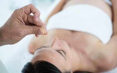 Acupuncture While Pregnant: Is It Right For You?