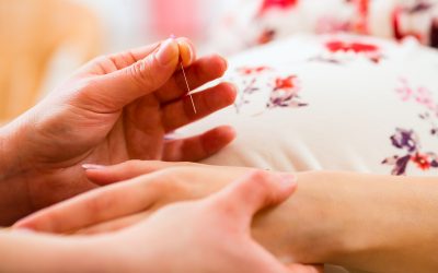 Why You Should Consider Acupuncture for Fertility