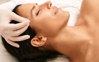 A Guide to Facial Acupuncture Points and Their Uses