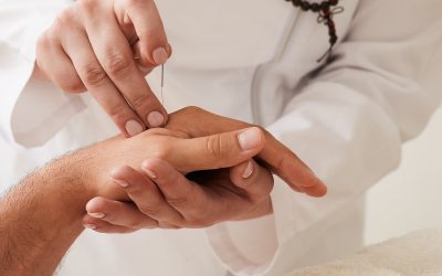 Using Acupuncture for Hand Pain Treatment