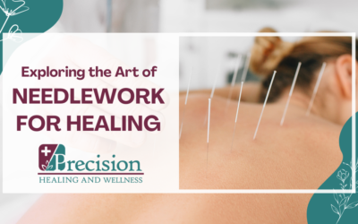 Acupuncture Techniques: Exploring the Art of Needlework for Healing