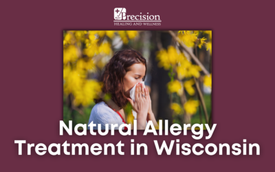 Natural Allergy Treatment in Wisconsin: How Acupuncture Can Help You Breathe Easy